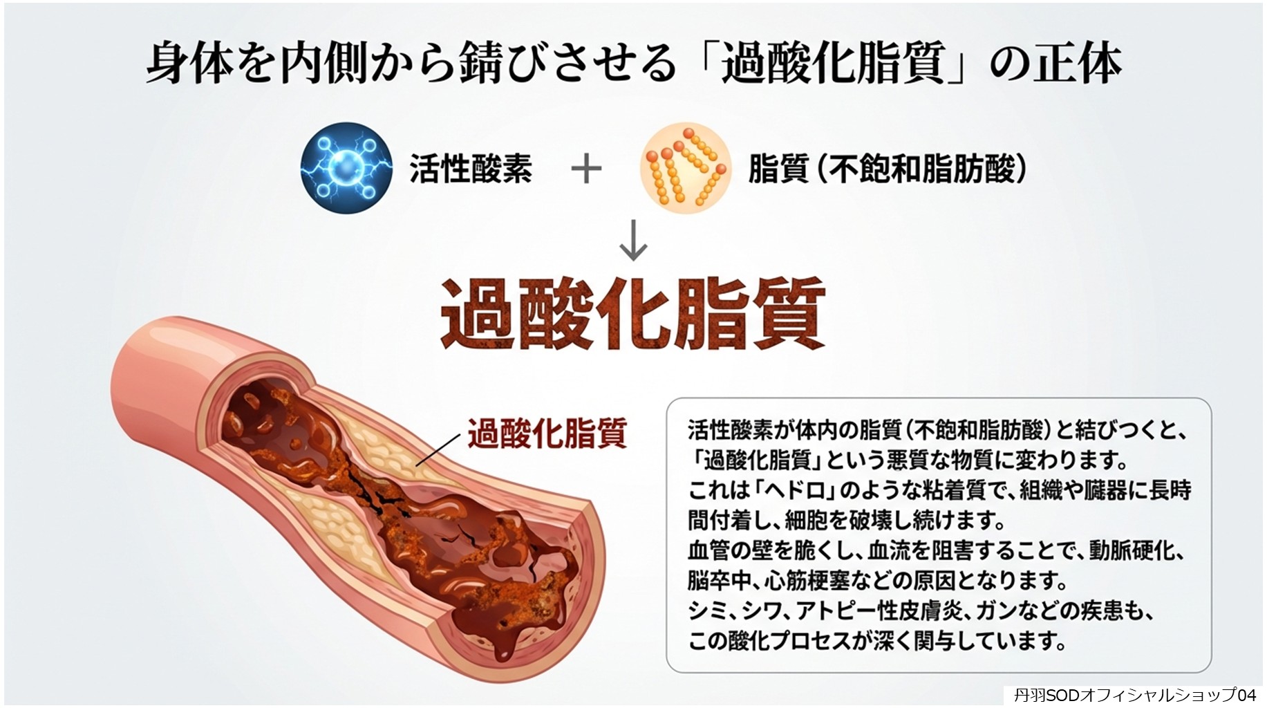 丹羽スペシャルSOD　丹羽SODとは　丹羽SODって何04